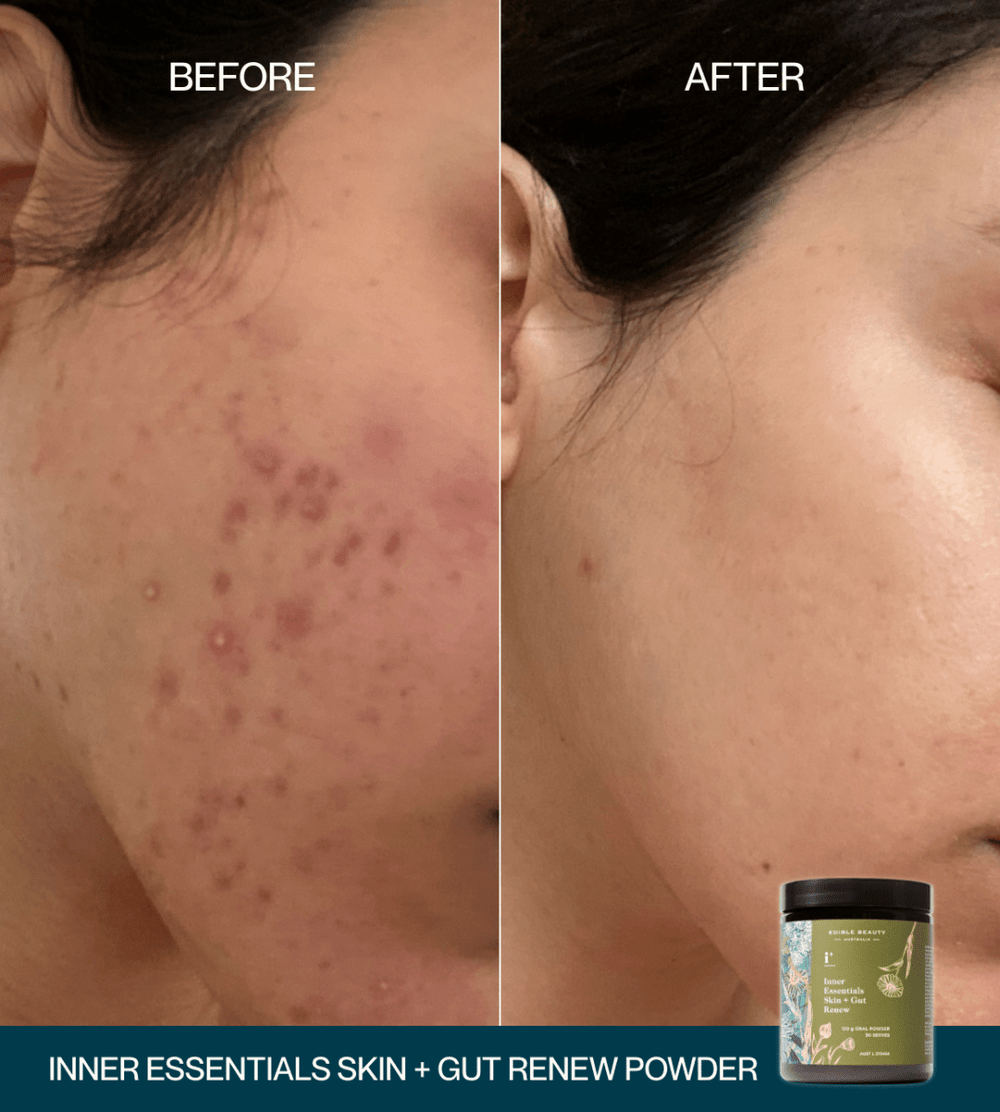 2 For 1 Skin + Gut Renew Powder