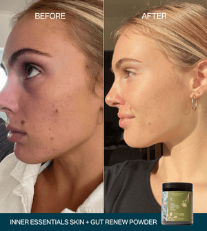 2 For 1 Skin + Gut Renew Powder