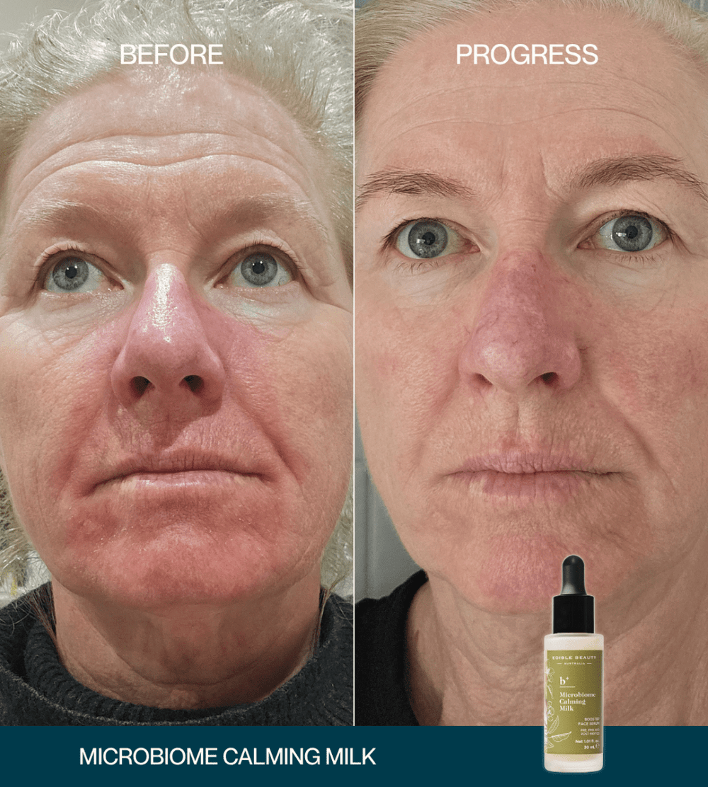 Microbiome Calming Milk Booster Serum