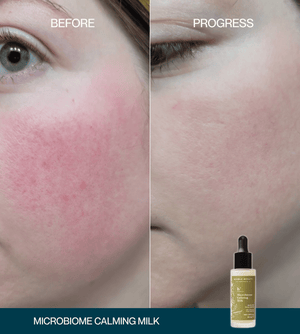Microbiome Calming Milk Booster Serum