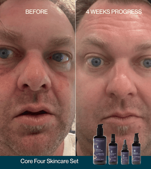 Natural Retinol Alternative Discovery Set