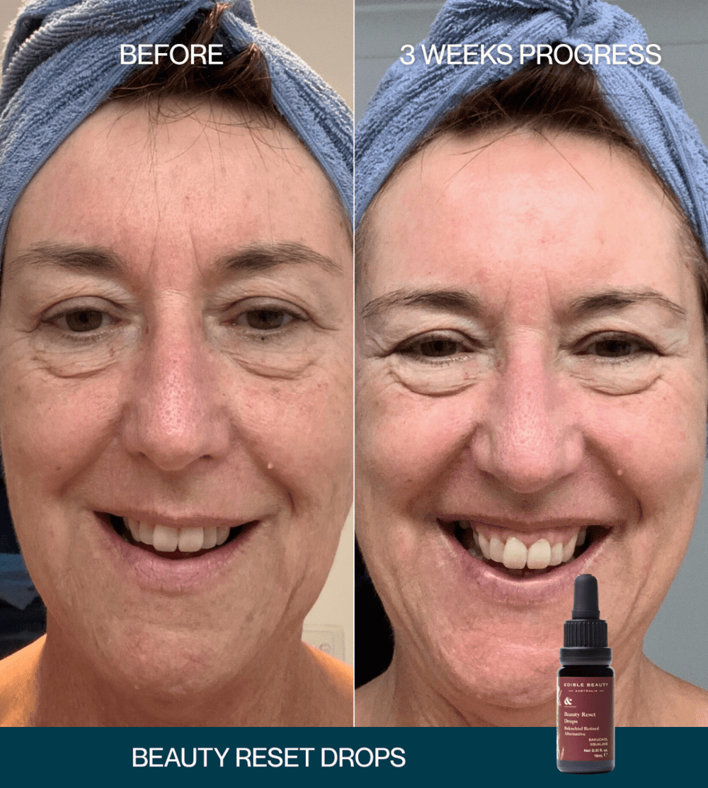 Natural Retinol Alternative Discovery Set