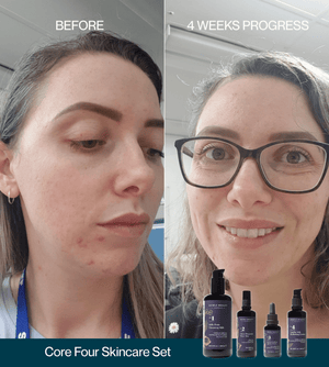 Natural Retinol Alternative Discovery Set